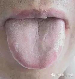 桃心舌头图片大全,揭秘甜蜜诱惑的神秘符号
