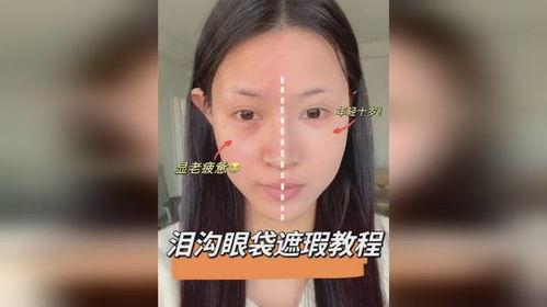 眼袋视频,跟随视频学习眼部护理之道